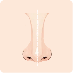 Nose symmetry